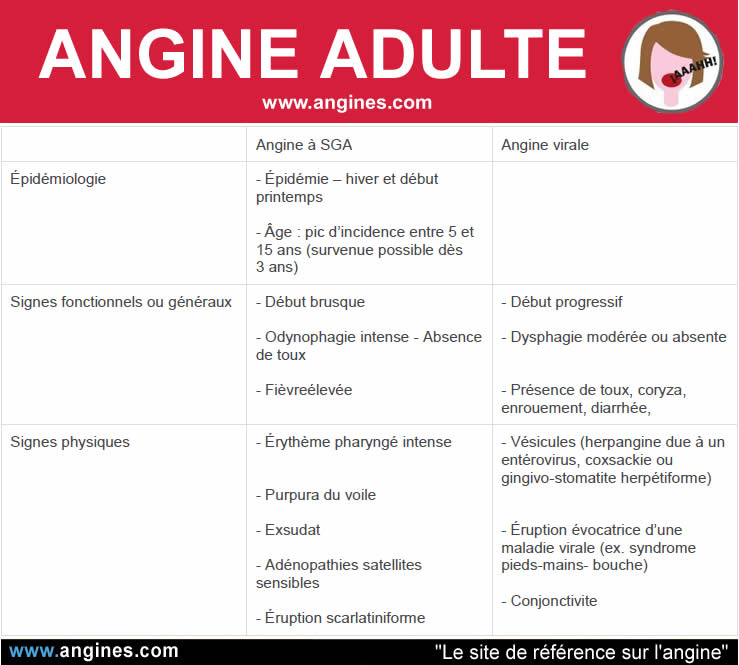 Angines : Angine chez les adultes