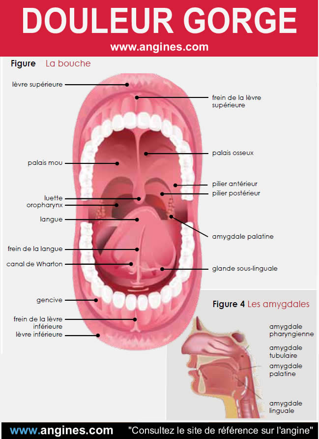 Douleur de gorge