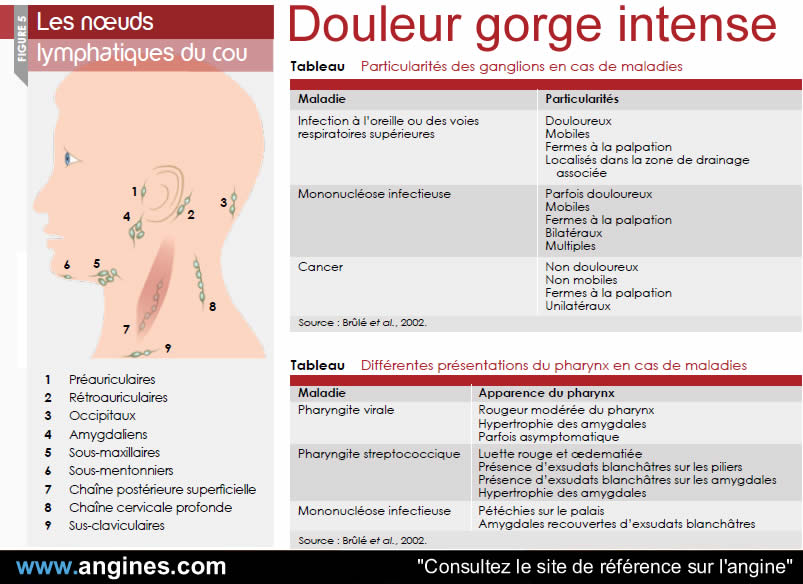 Douleurs gorge