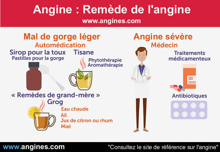 Angine : Remède angine