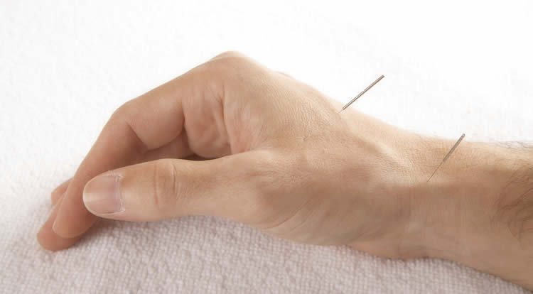 Angine : Acupuncture angine